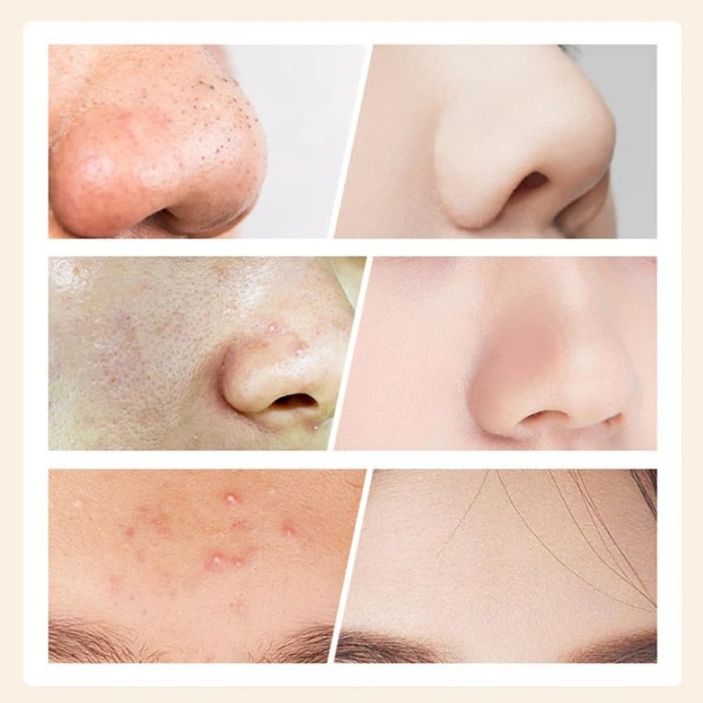 FreshSkin™ | Alltid en vacker och slät hud