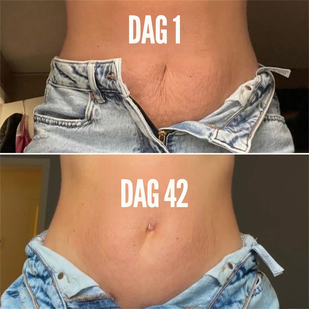 RenewSkin™ | Slät hud utan ärr