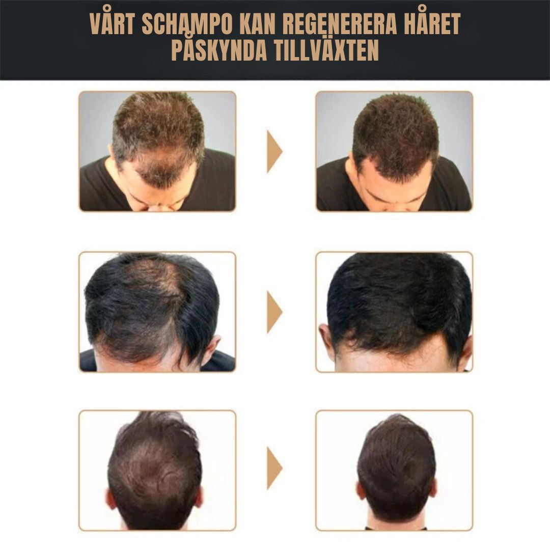 HairBoost™ | Alltid fylligt hår