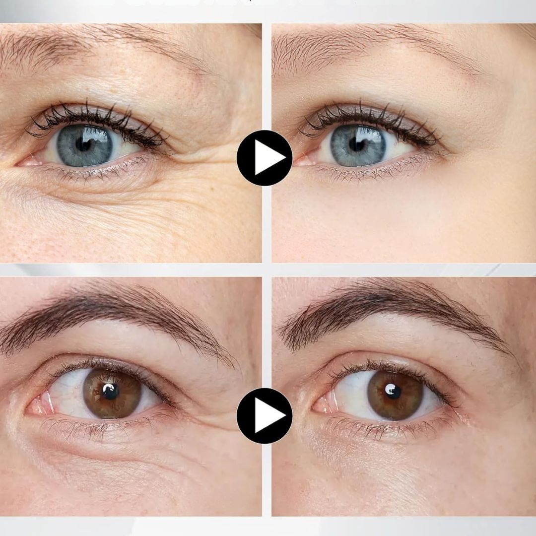 EyeNova™ | Inga fler påsar och mörka ringar