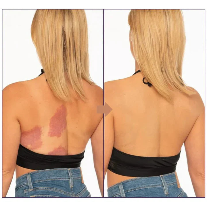 GlowSilk™ | För hud som strålar och andas