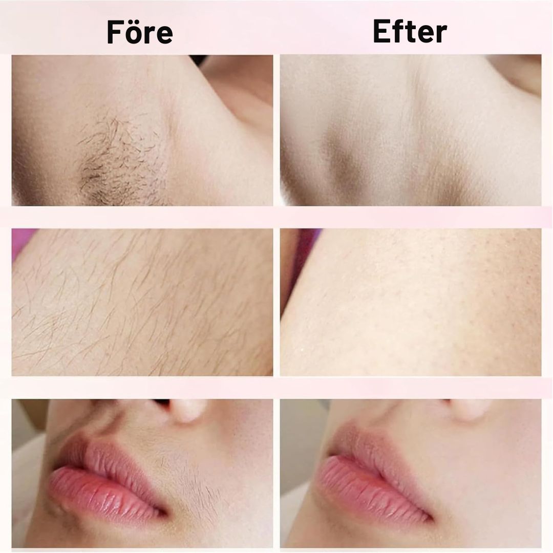 Trimora™ | Slät på ett drag överallt